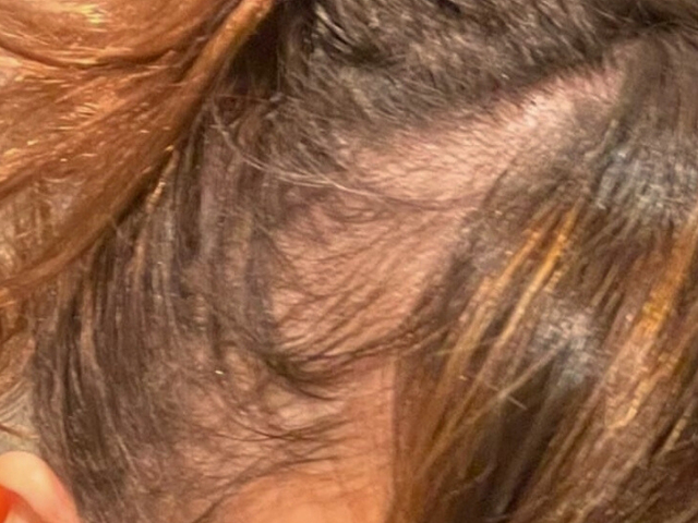 Haar vor der KORALLS Routine