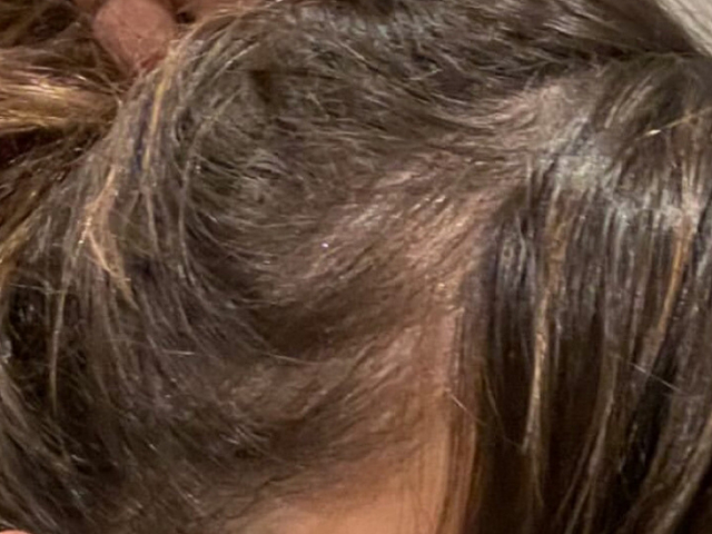 Haar nach der KORALLS Routine